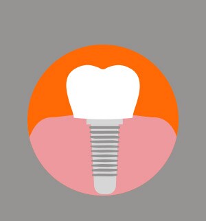 implante dentário na gengiva