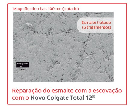 Reparação do esmalte Reparação do esmalte