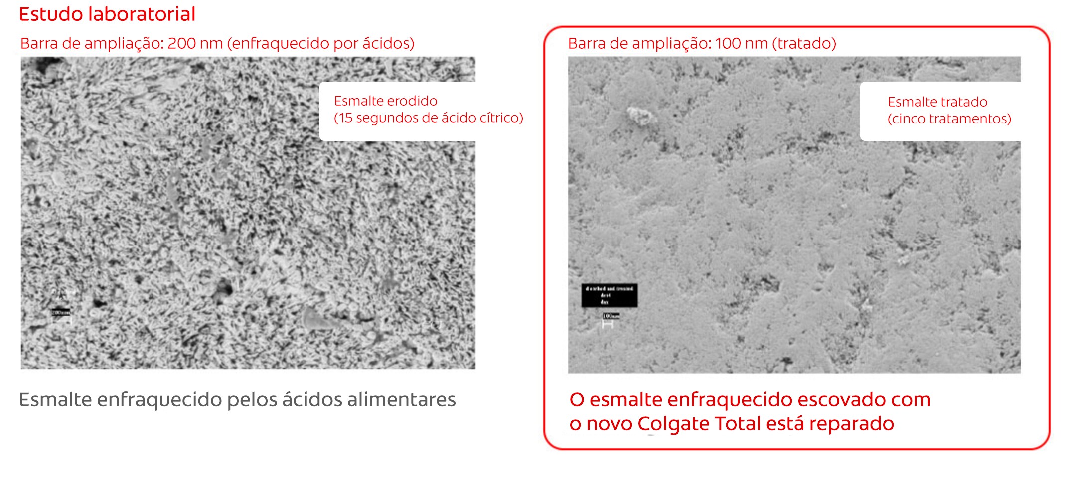 Protege o esmalte